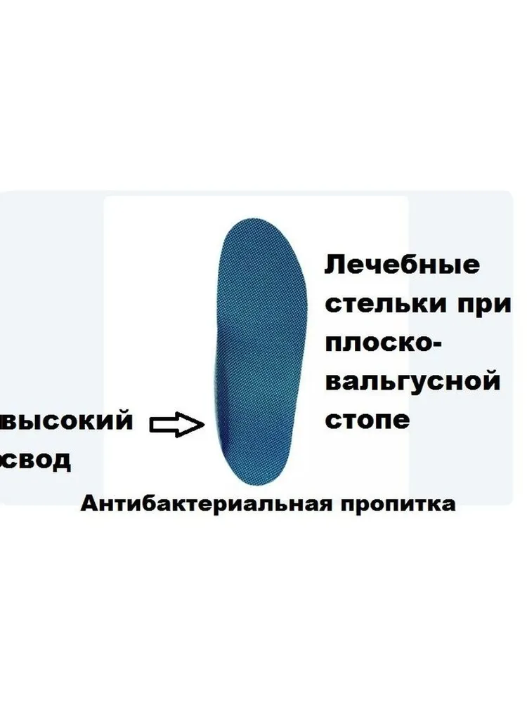 Детские лечебные стельки при плоско-вальгусной стопе 138 1